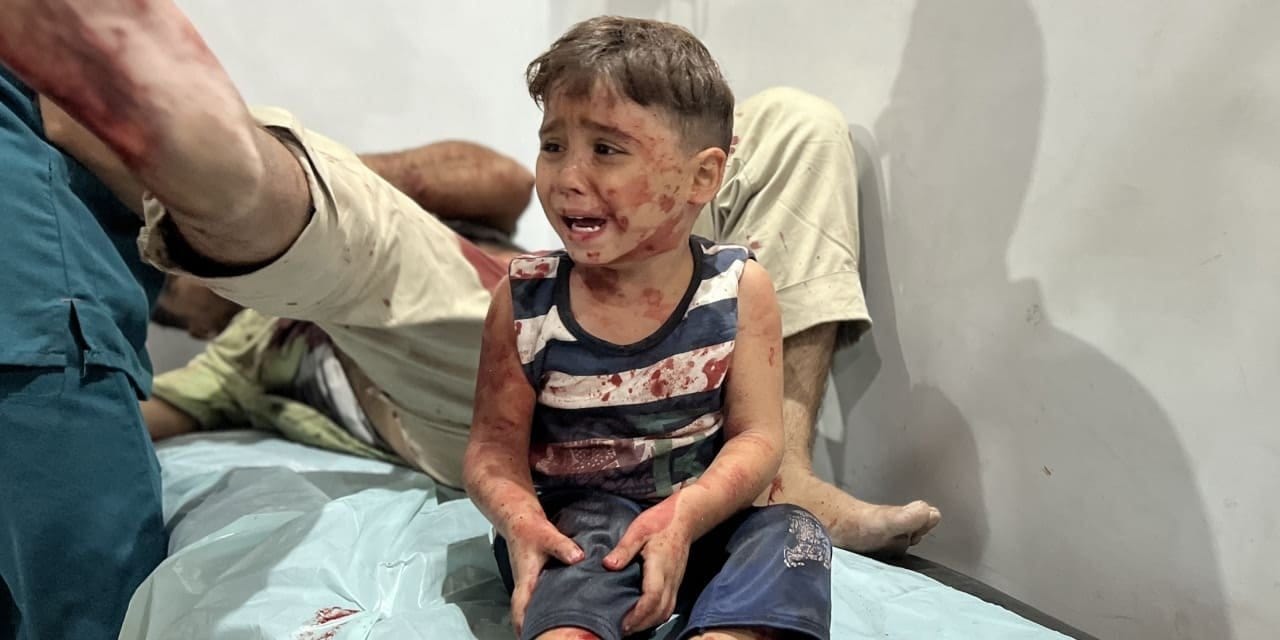 israilin abluka uyguladigi gazze seridinde acliktan olenlerin sayisi artiyor ncnizRtk